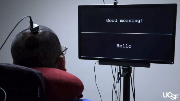 استفاده از تکنولوژی Deep Learning برای ترجمه سیگنال صوتی مغز به متن