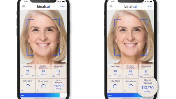 اندازه گیری فشار خون با دوربین گوشی هوشمند